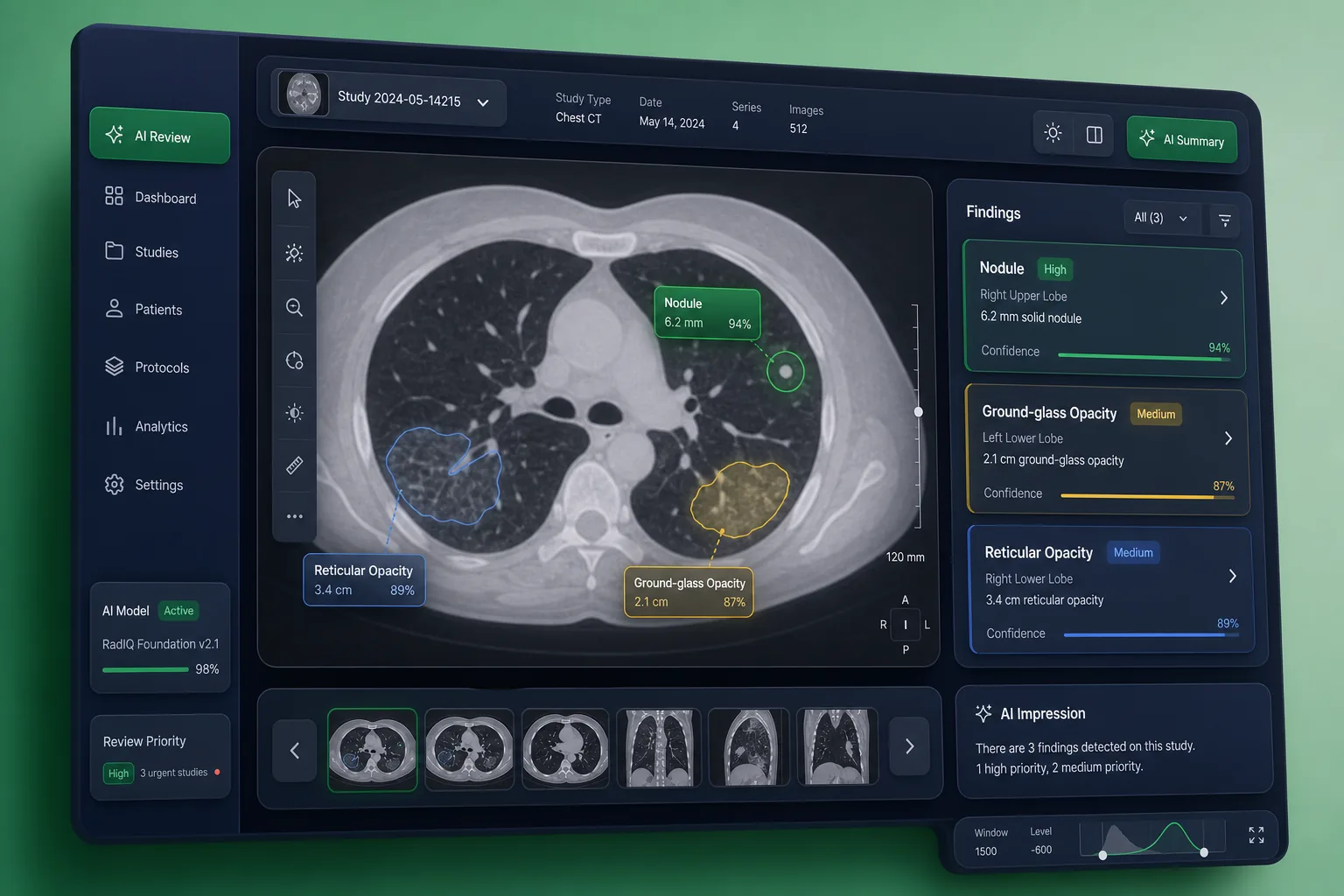 AI Triage for Chest X-Ray and CT Scans — core workflow screen